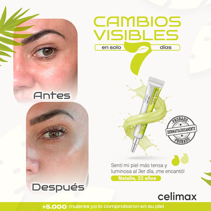 CELIMAX® - Adiós a ojeras y flacidez en días